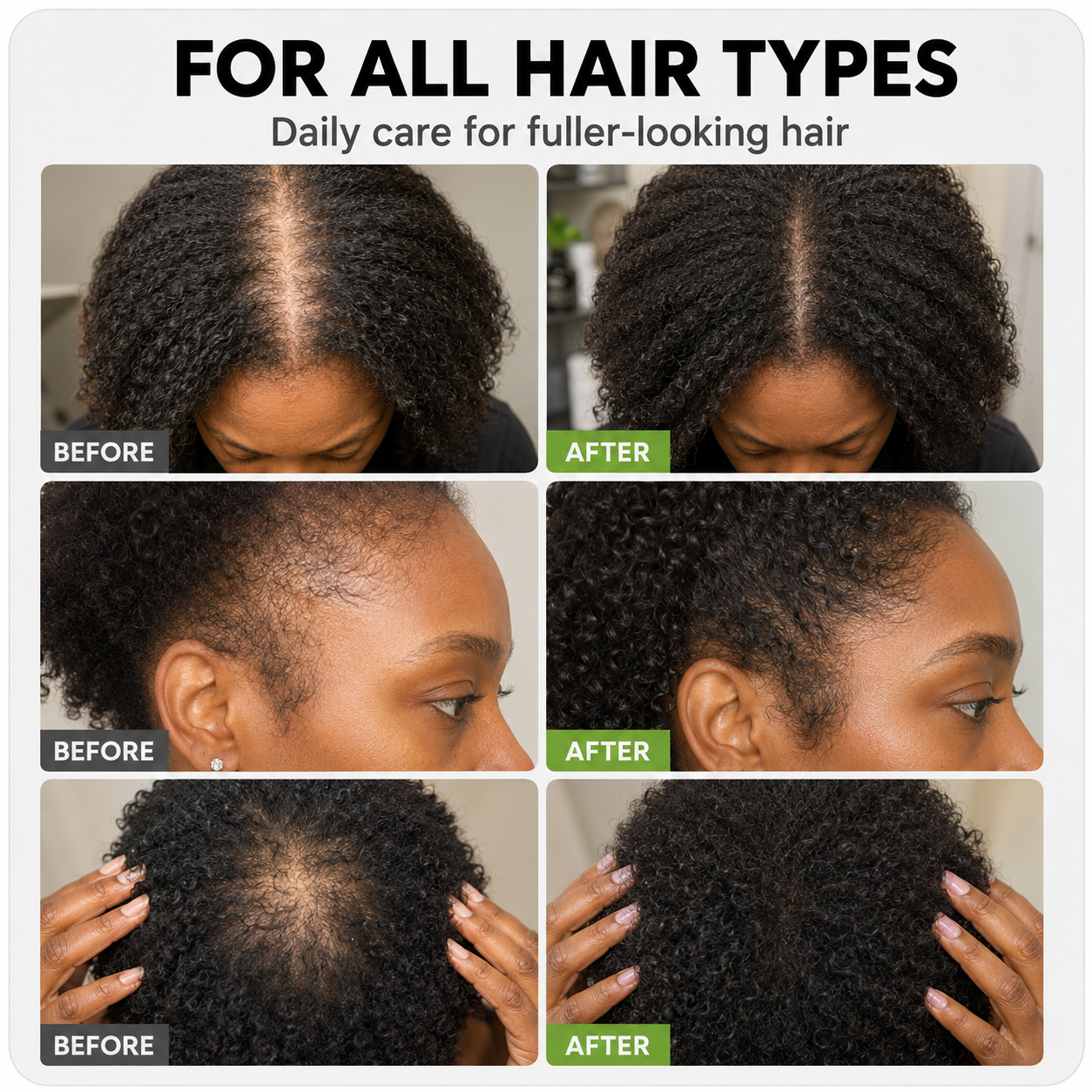 Root Bloom™ Hair Growth Spray